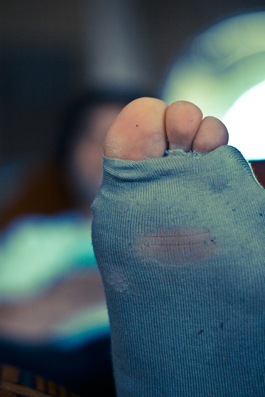 Děravá ponožka